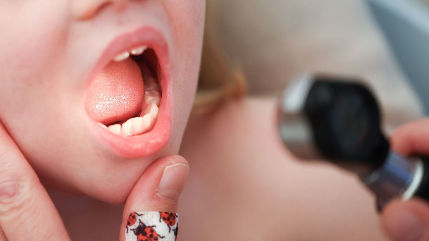 Medizin: Landkinderarzt-Quote in Rheinland-Pfalz rückt näher