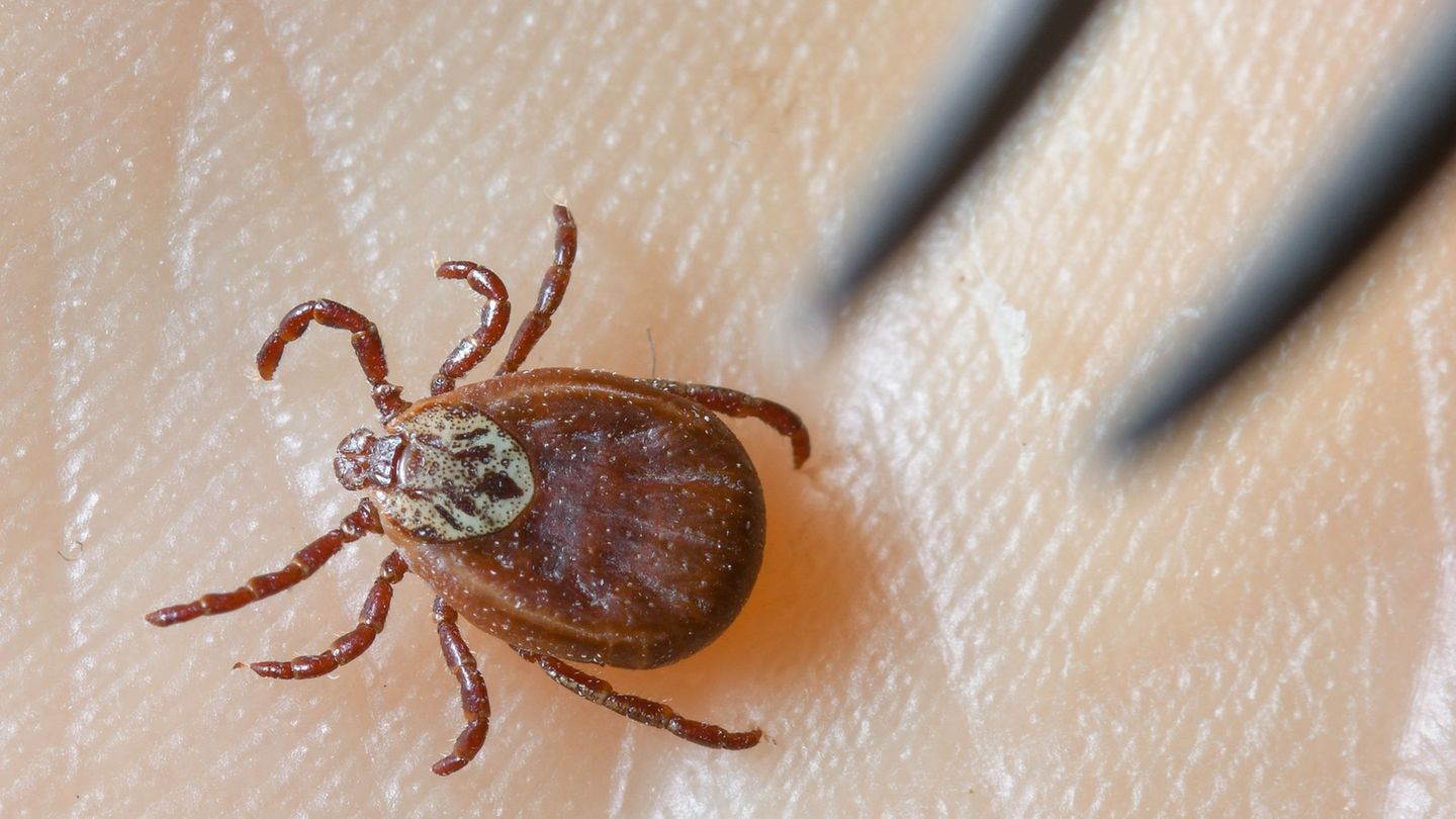 Krankheiten: Zeckensaison: Mehr Borreliose-Fälle in Berlin als früher