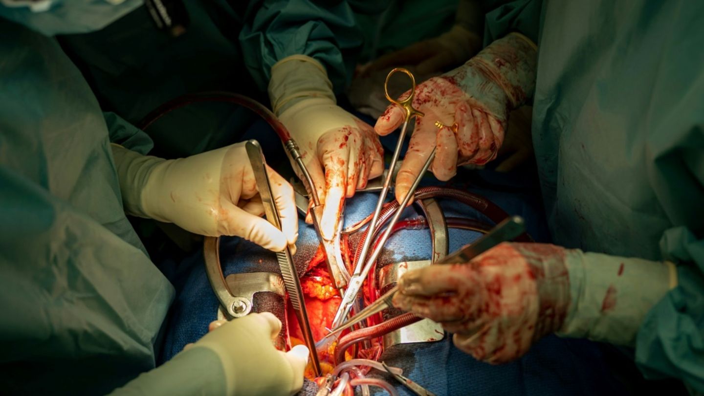 Bundesinstitut: Bislang rund 330.000 Menschen in Organspenderegister verzeichnet