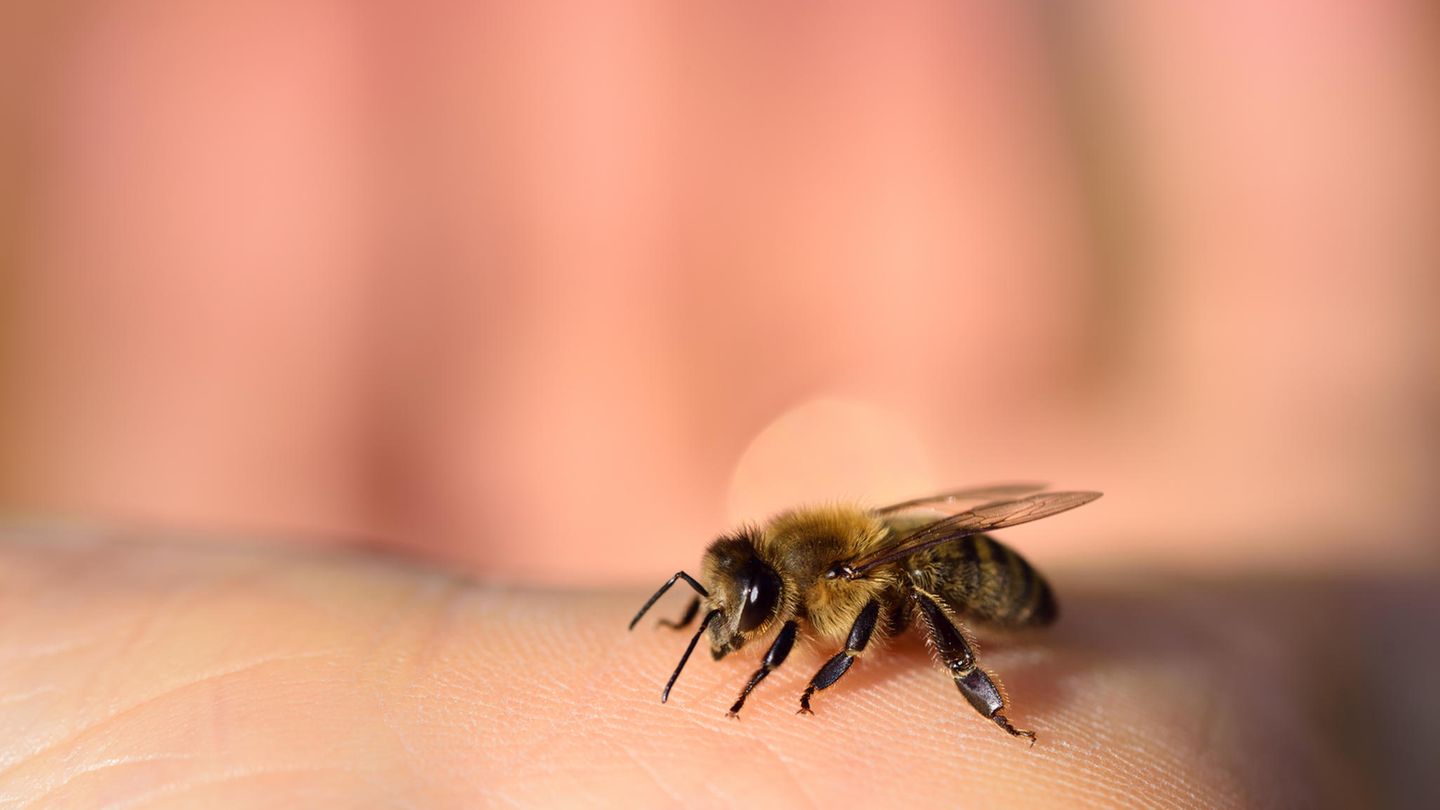 Gut zu wissen: Was wirklich hilft, wenn man von einer Biene gestochen wurde