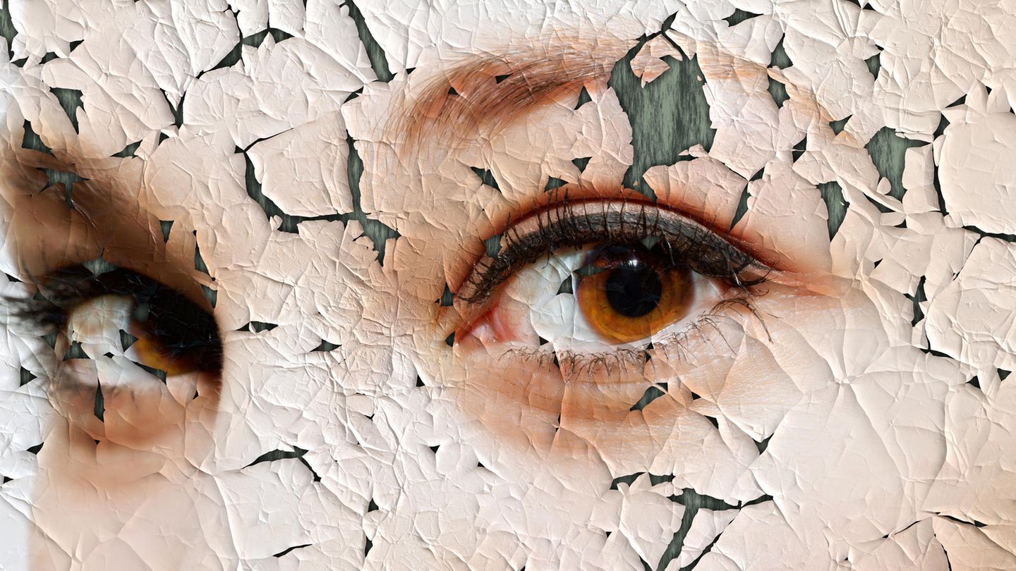 Pflegetipps: Trockene Gesichtshaut: So behandeln Sie raue oder juckende Partien